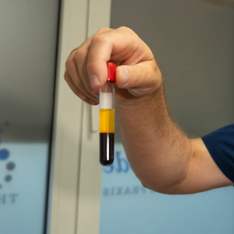 Dr. Meschede hält ein Röhrchen mit aufbereitetem Eigenblut für eine PRP-Behandlung